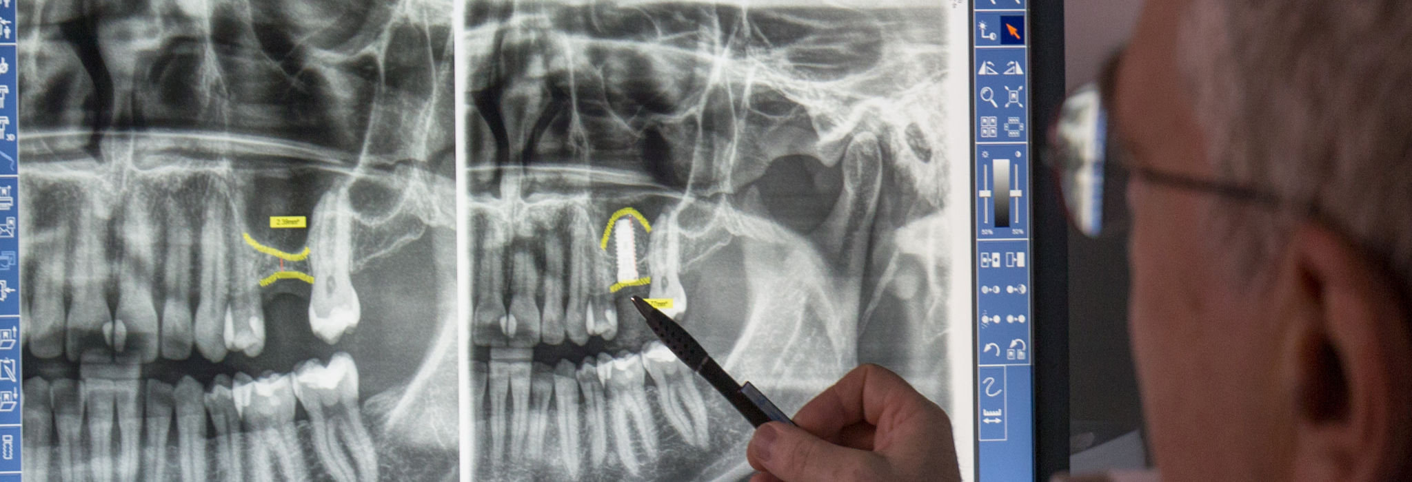 Bone Construction / Augmentation